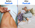 2026 Upgraded Pest Repeller - Banish Bed Bugs For Good